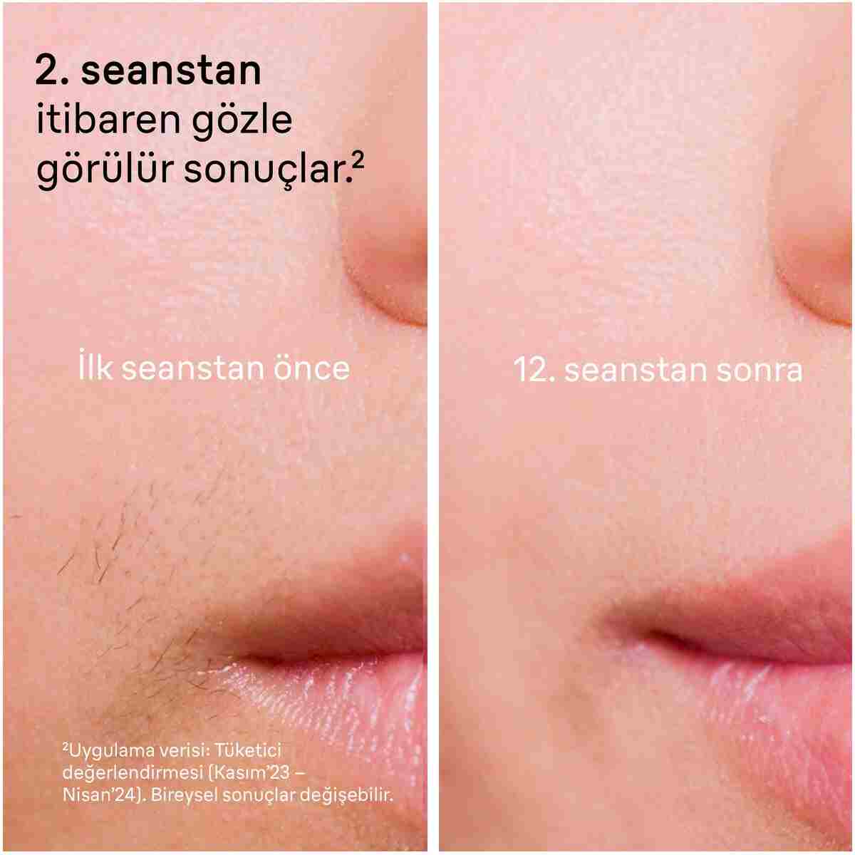 Braun IPL Silk·expert Pro 5, Evde Lazerle Tüy Alma, Mini Yüz Tüy Alma Cihazı, 2 Başlık, PL5146 - Görsel 3