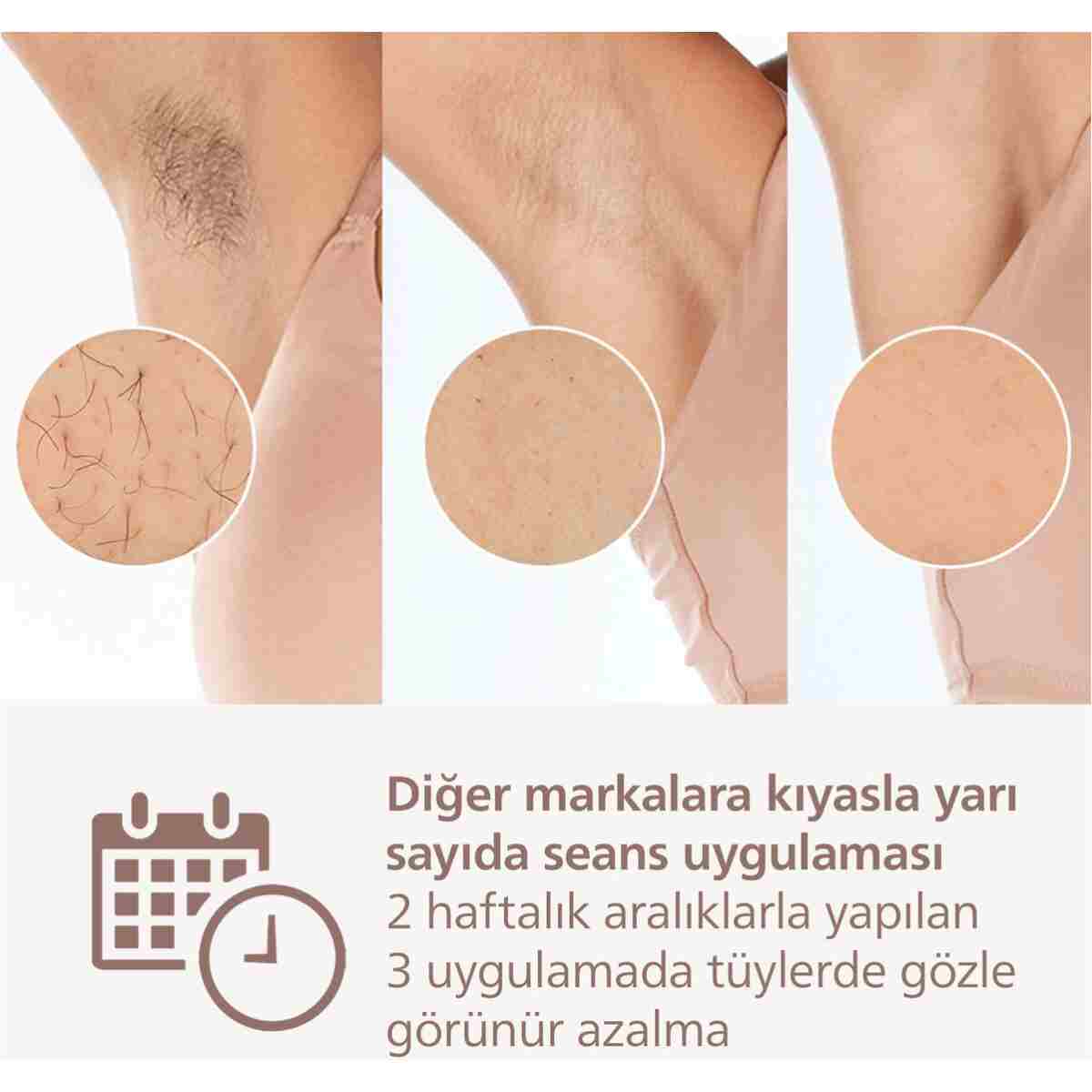 Philips Lumea 9900 Serisi BRI951/03 IPL Tüy Alma, SkinAI,Vücut,Yüz,Koltuk altı,Bikini,4 Başlık,Çanta - Görsel 4