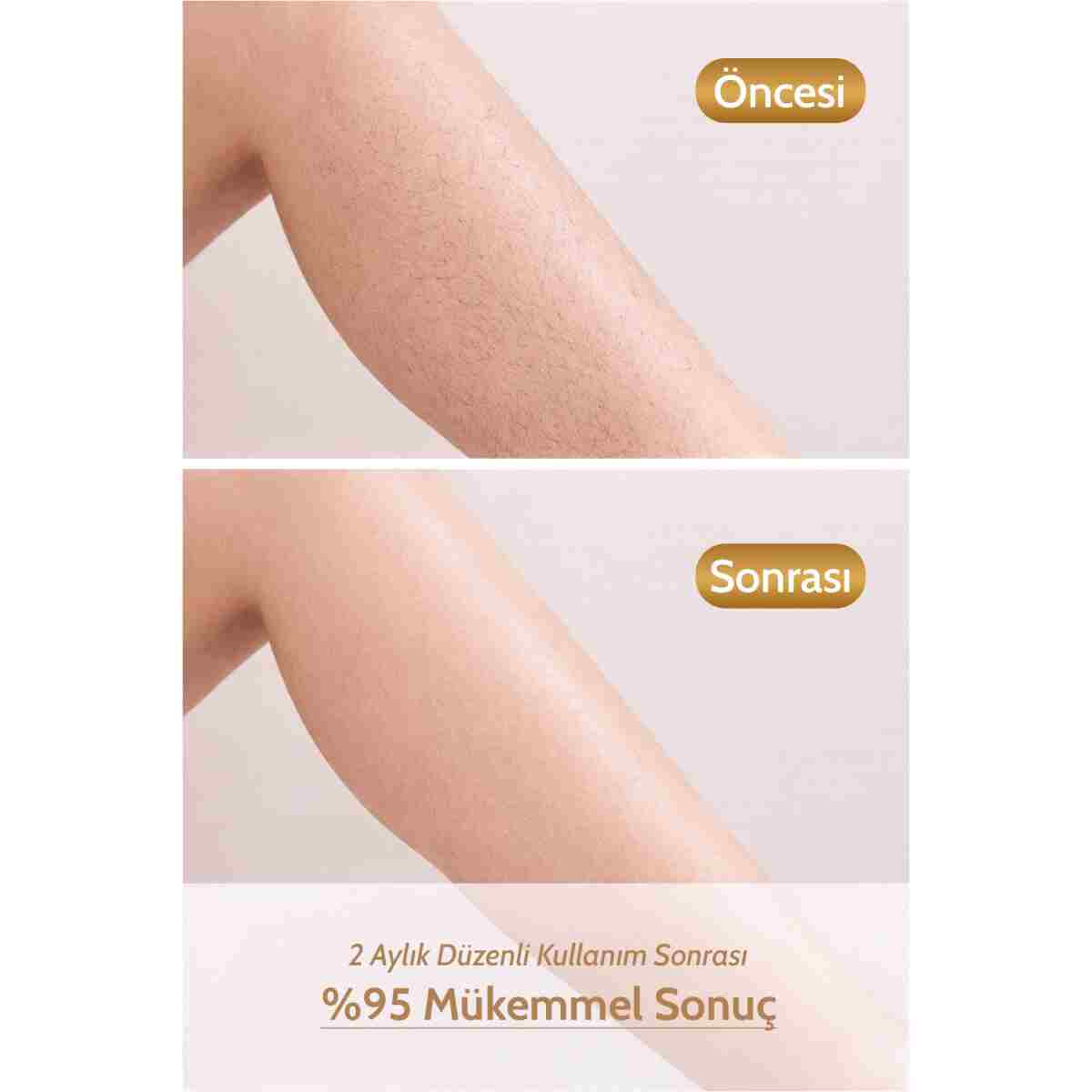 GoldMi Ipl Buz Lazer Epilasyon Cihazı - Sınırsız Atım Cilt Gençleştirme Otomatik/Manuel 21J Yüksek Enerjili - Görsel 9