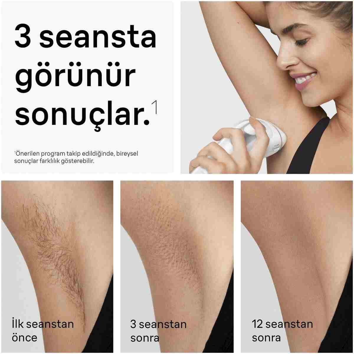 Braun IPL Silk·expert Pro 3, Evde Lazerle Tüy Alma, Çanta, Gillette Venus, 2 Başlık, PL3122 - Görsel 3