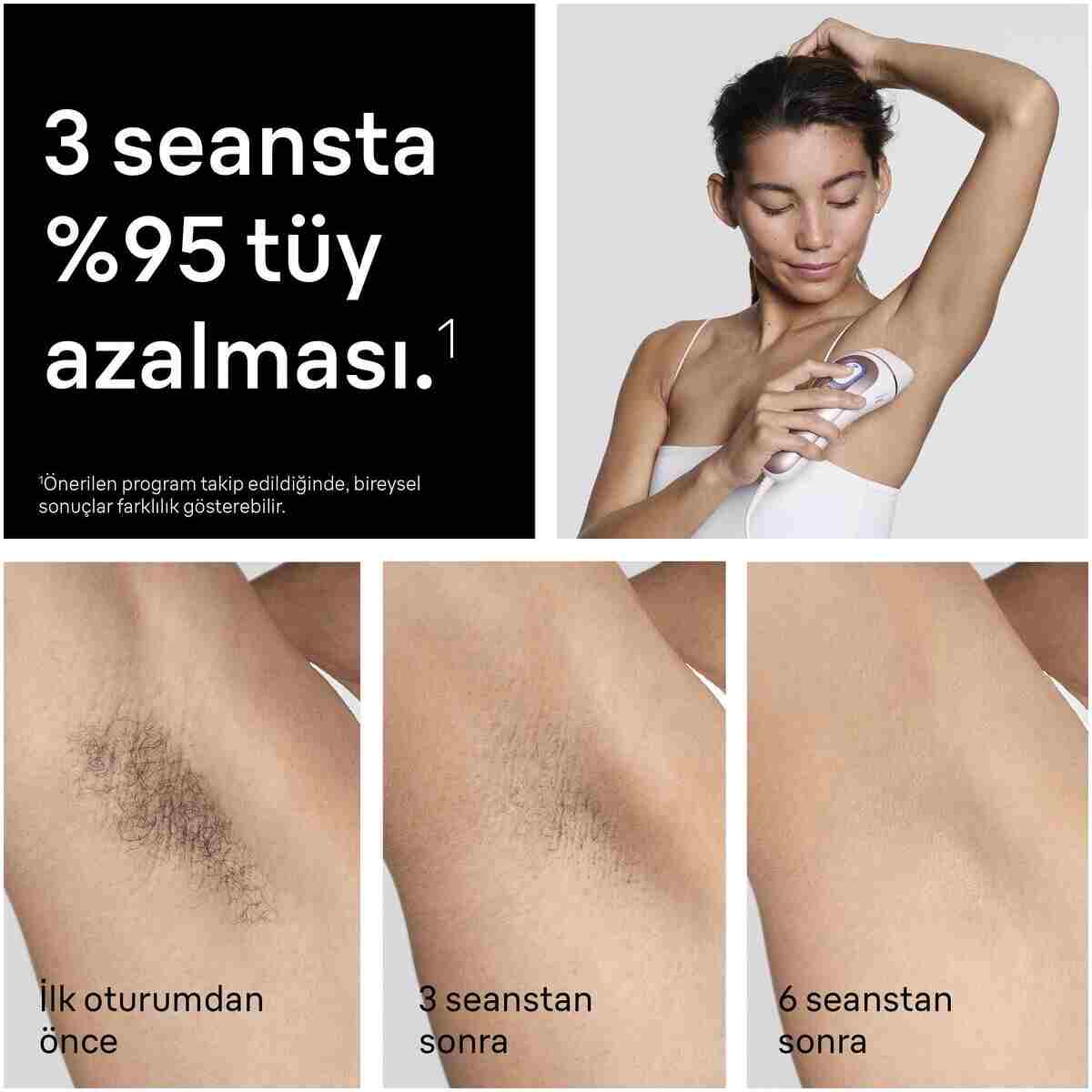 Braun IPL Skin i·expert, Evde Lazerle Tüy Alma, App ile, Çanta, Gillette Venus, 3 Başlık, PL7321 - Görsel 12