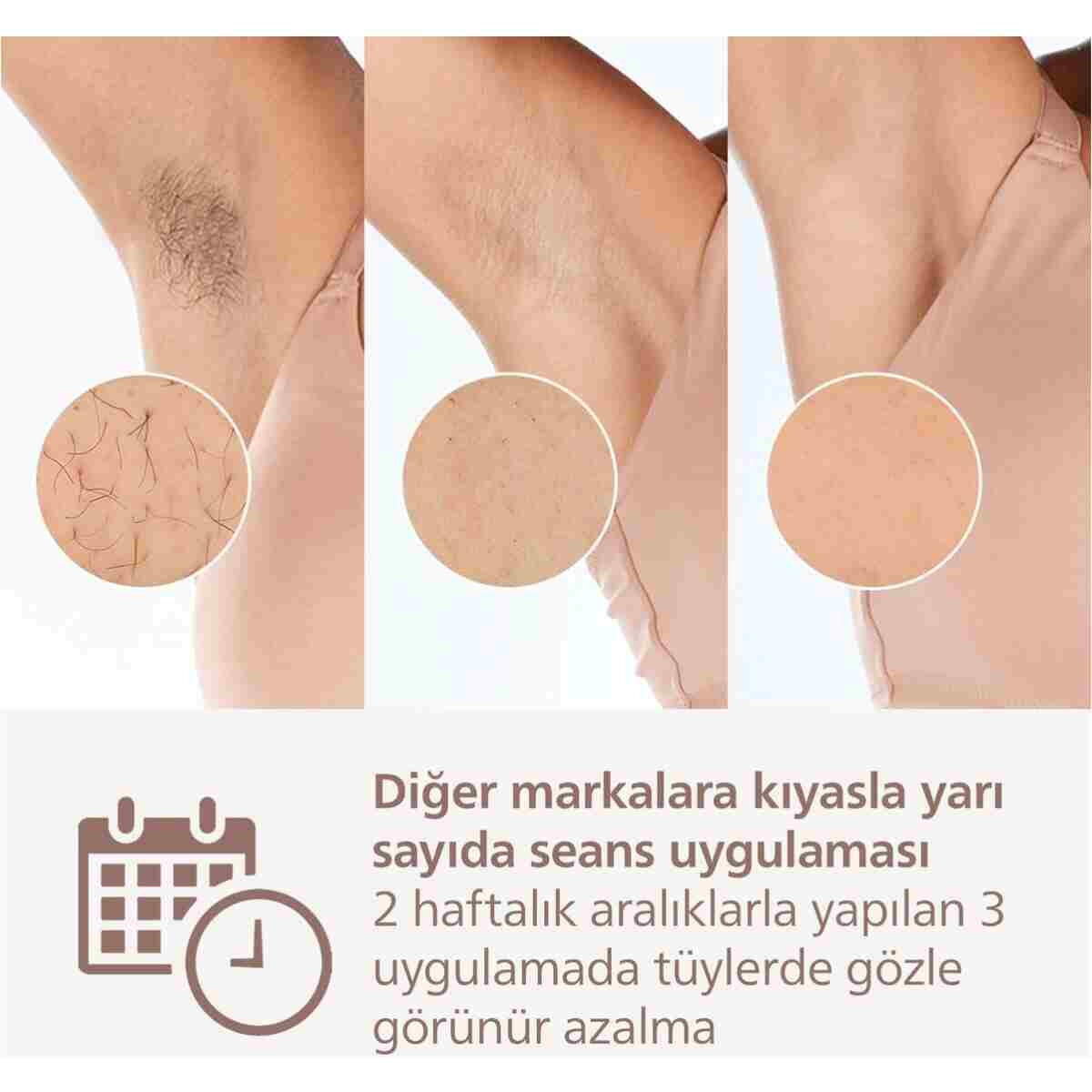 Philips Lumea 8000 Serisi BRI940/00 IPL Tüy Alma, Vücut için 1 Başlık, Çanta - Görsel 4