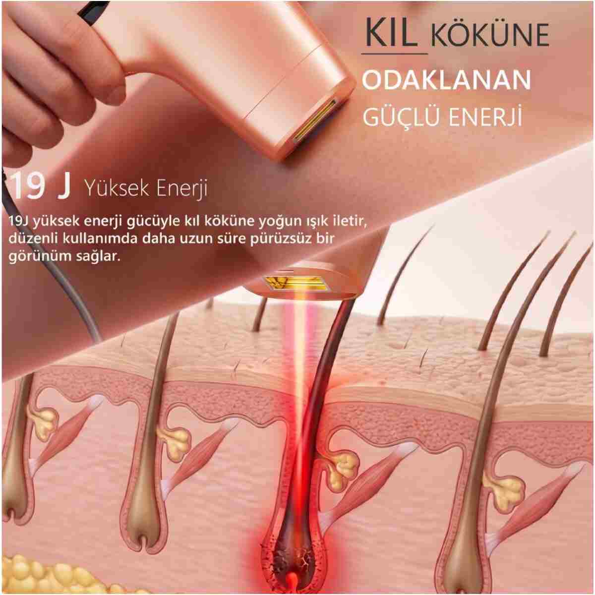 ROBX A05 3 Milyon Atım Akıllı Cilt Tanıma Ultra Seri Atım 3 Başlık IPL Lazer Cihazı - Görsel 8