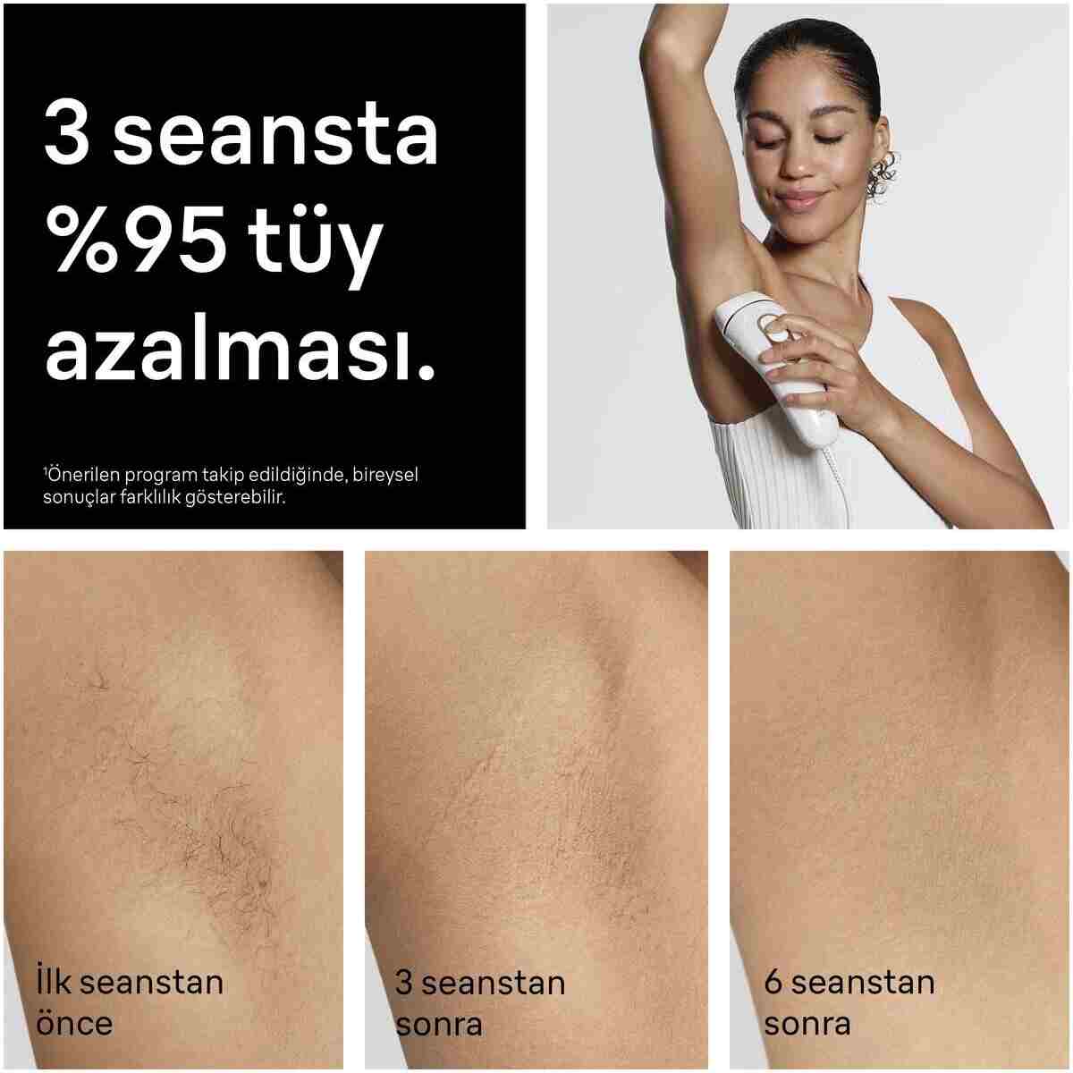 Braun IPL Silk·expert Pro 5, Evde Lazerle Tüy Alma, Çanta, Gillette Venus, 2 Başlık, PL5251 - Görsel 4