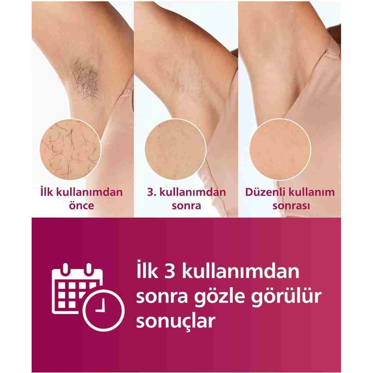 Philips BRI950/00 Lumea Lazer Epilasyon IPL Tüy Alma Cihazı,ÇantaHEDİYELİ,Kablolu/Kablosuz Kullanım - Görsel 10