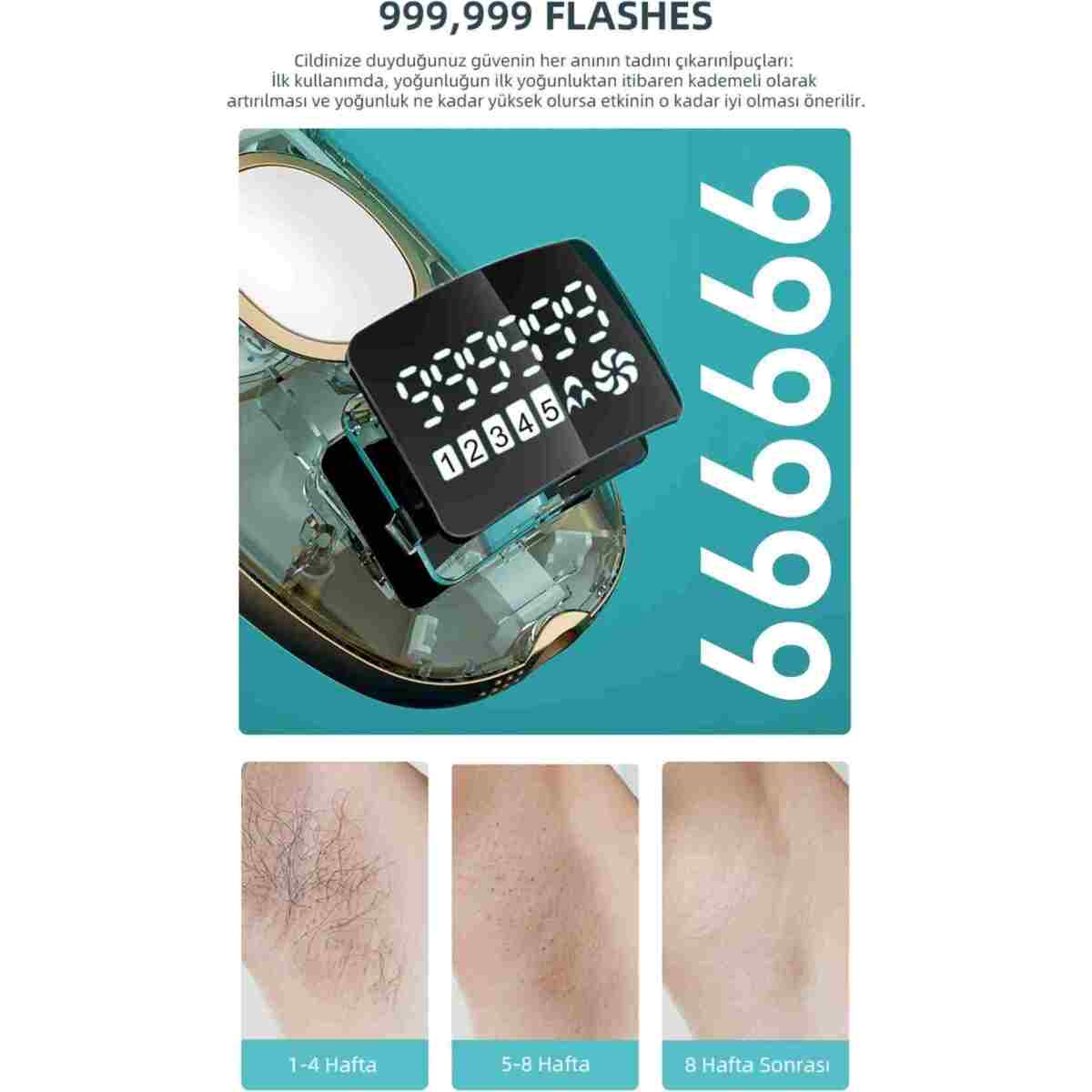 YUES IPL Lazer Epilasyon Cihazı – 999.999 Atım, Otomatik/Manuel Mod, Ev Tipi Yüz & Vücut - Görsel 12